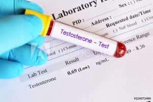 testing for low testosterone